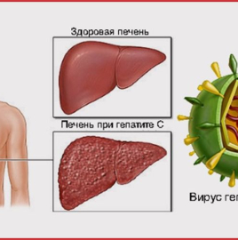 Острый вирусный гепатит С и меры профилактики.
